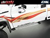 KILLERBODY DETAIL SCALE PEDAL ANTISKID PLATE & ABS KB48601